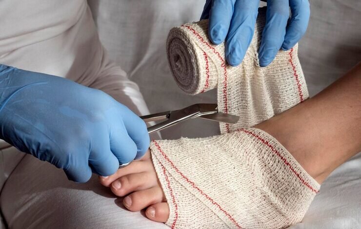 wellhealthorganic surgery for wrist and ankle injuries